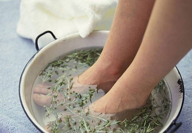 Fürdő gyógynövényfőzetes körömgomba ellen