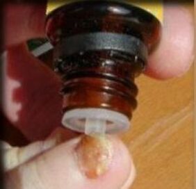 Cseppek alkalmazása gombás körömre