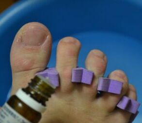 Felkészülés a köröm kezelésére gombaellenes cseppekkel